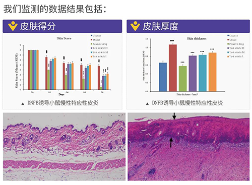 5001拉斯维加斯建立的特应性皮炎及湿疹模型监测数据结果