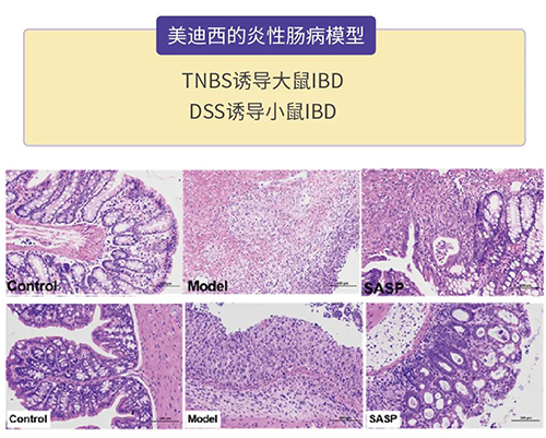 5001拉斯维加斯的炎症性肠病模型