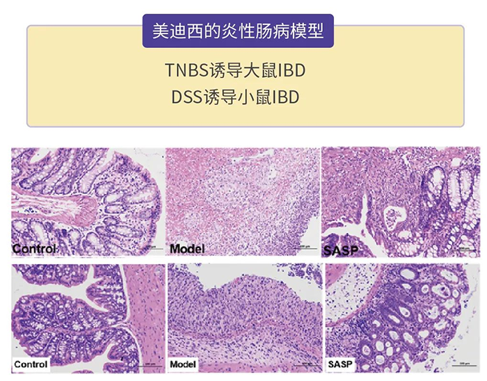 5001拉斯维加斯的炎性肠病模型.png 5001拉斯维加斯的炎性肠病模型.png